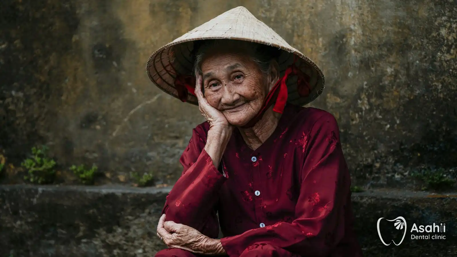 Người cao tuổi mỉm cười: mất răng lâu năm vẫn có nhiều cách phục hồi phù hợp