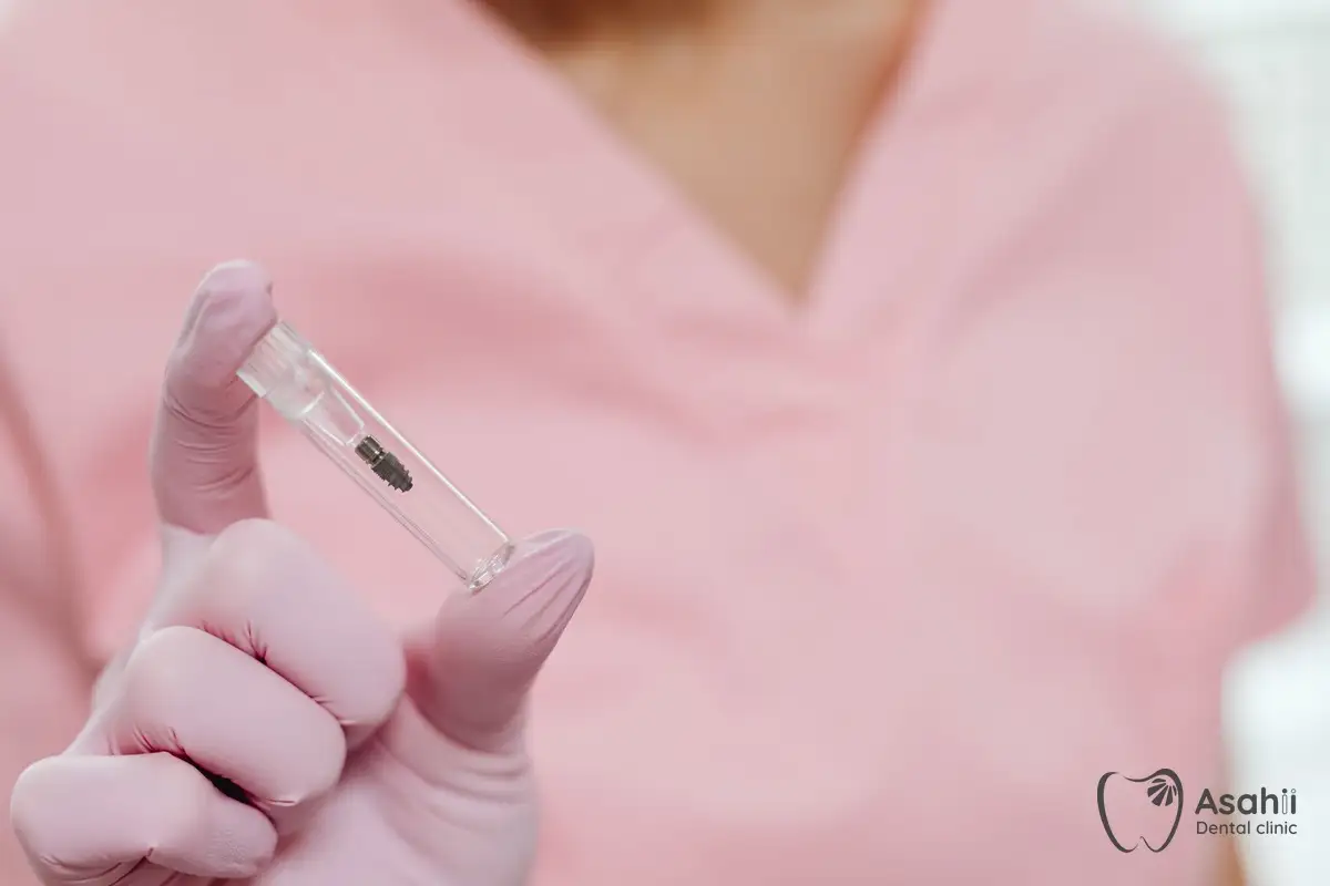 Trụ implant trong ống vô trùng, được đặt vào xương hàm ở bước đặt trụ