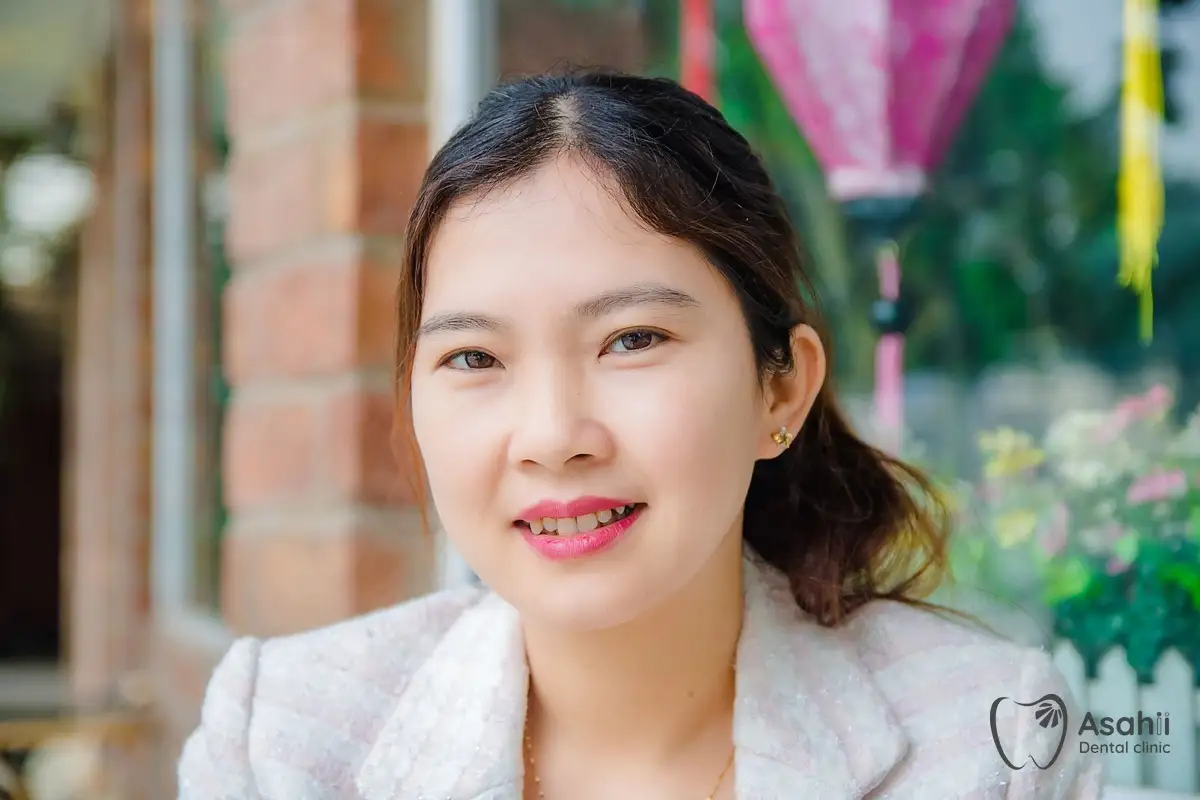 Giữ màu răng sau tẩy trắng: hạn chế cà phê, trà, thuốc lá và chải răng đều đặn